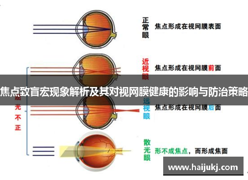 焦点致盲宏现象解析及其对视网膜健康的影响与防治策略